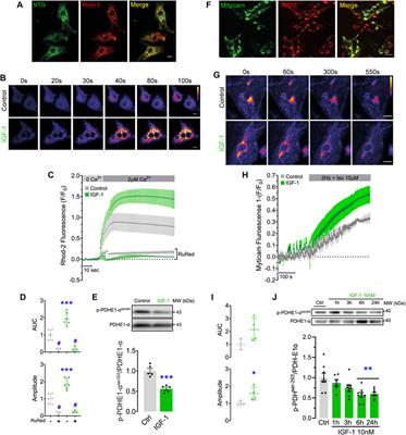IGF-1 boosts mitochondrial function by a Ca2+ uptake-dependent mechanism in cultured human and rat cardiomyocytes